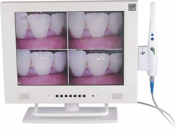 Intraoral Camera With Screen-MLG-Taiwan